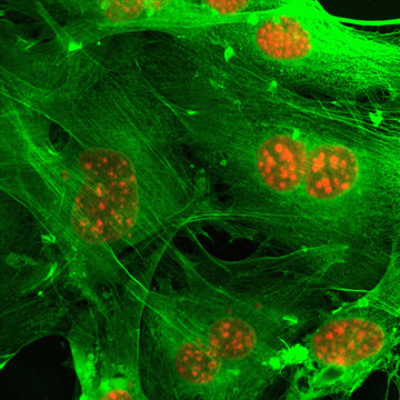 Microscopic image of fusion of cell nuclei in breast cancer cells