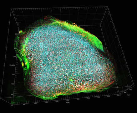 Transparent tumor tomography visualising tumor microenvironment, showing vascular network in a mouse model for HER2-positive breast cancer