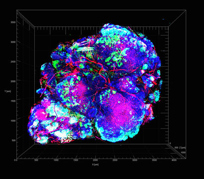 Transparent tumor tomography visualising tumor microenvironment, showing a mouse model for HER2-positive breast cancer with hypoxic areas of cancer cells in green