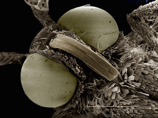 Scanning electron micrograph of the head of a moth