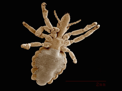 Scanning electron micrograph of a hog louse (Phthiraptera: Hematopinidae)