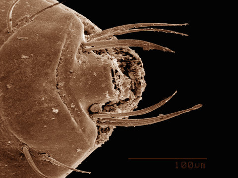 Scanning electron micrograph of a hog louse (Phthiraptera: Hematopinidae)