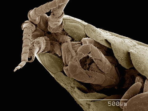Scanning electron micrograph of a freshwater amphipod (Hyalella sp)
