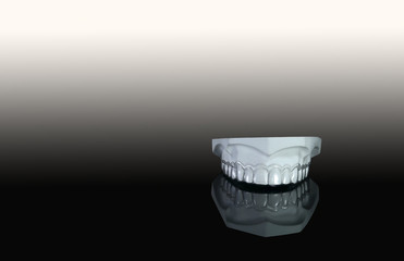Clear retainer in model