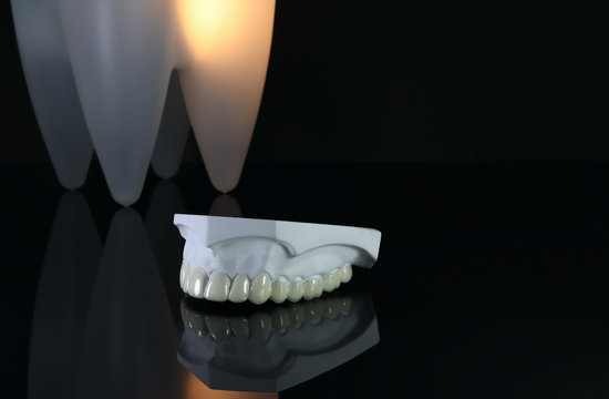Cosmetic splint