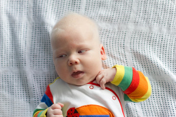 Whitehair babyboy with albinism syndrome