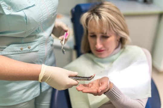 dentist removes the tooth patient at the dental clinic