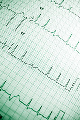 Electrocardiogram