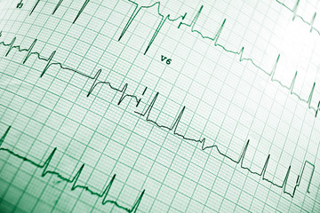 Electrocardiogram