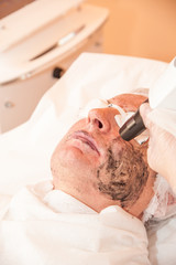 Obraz premium carbon laser treatment skin / laser treatment