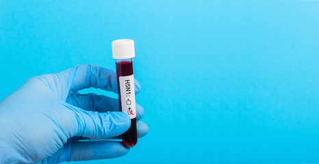 Sample of blood in vitro to the hand in glove