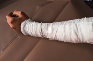 arm wound