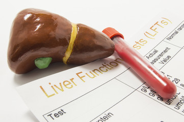 Figure of human liver, laboratory test tube or bottle with blood and paper result of liver function or enzyme test (LFTs) analysis are on doctor table. Concept to represent liver function test or exam