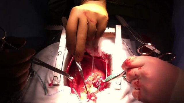 cardiac surgery