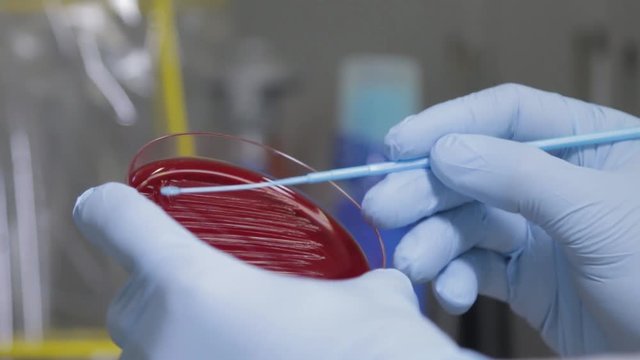 Probe einer Bakterienkultur von N&auml;hrmedium wird gesammelt