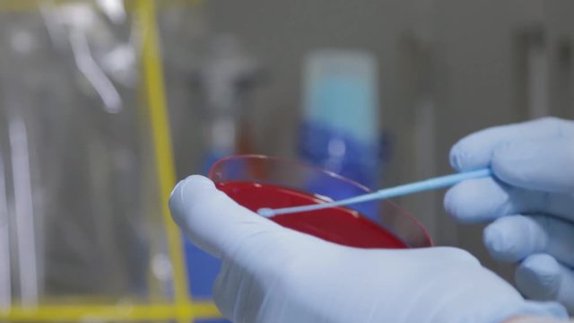 Aufbringen von Bakterienkultur auf N&auml;hrmedium