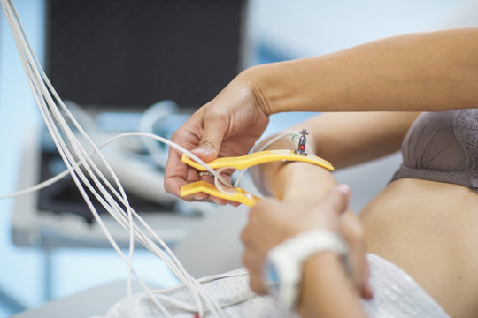 Electrocardiogram