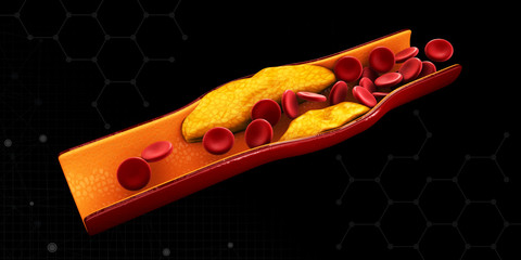 3d Illustration of blood cells with plaque buildup of cholesterol isolated Black