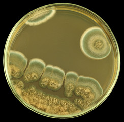Colonies of of allergic mould from air spores and/or biologically damaged constructions on a petri dish (agar plate) manually isolated on a black background. Focus on full depth.