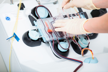 Plasmapheresegerät zur Trennung von Blutplasma und Serum bei Blutspenden wird von MTA bedient