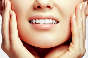 Fototapeta premium Part of the face close-up, toothy smile, concept after bleaching. Beauty care. Teeth whitening