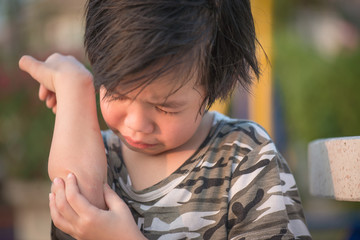 asian child injured at elbow