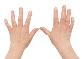 woman's hands with wrinkles