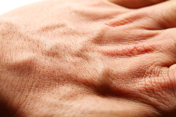The hand external skin see the texture of blood vessel under the outer skin represent the...