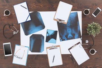 X-ray picture and stethoscopes - obrazy, fototapety, plakaty