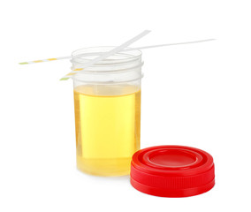 Opened specimen cup of urine and reagent test strips isolated on white