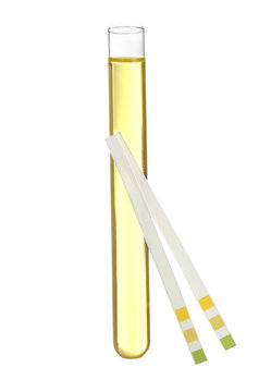 Test strips and tube with urine on white background
