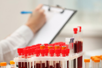 Test tubes filled with blood in laboratory