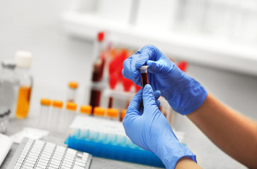 Scientist working with blood sample in laboratory