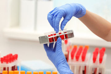 Scientist working with blood samples at laboratory