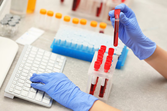 Scientist entering data of blood sample in computer at laboratory
