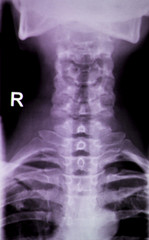 Spine neck Xray test scan