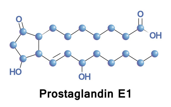 Prostaglandin E1, also known as alprostadil, is a prostaglandin which is used as a medication. In babies with congenital heart defects it is used by injection into a vein to open the ductus arteriosus