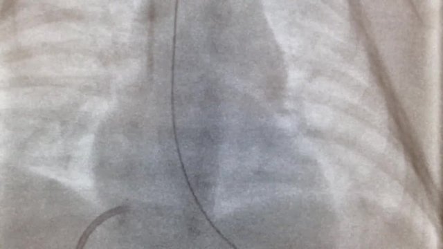 cardiac catheterization and great vessels