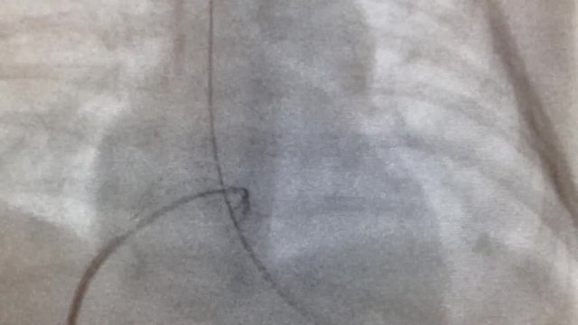 cardiac catheterization and great vessels
