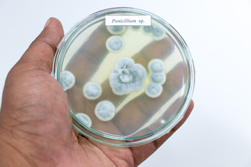 Fungus in Petri dishes on table gray in Lab.