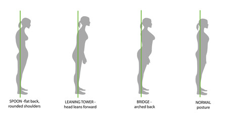 silhouette of women with correct and incorrect posture. vector illustration.