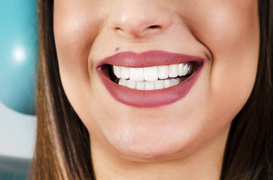 Closeup young woman smiling and showing beautiful white teeth sitting in dentist chair 