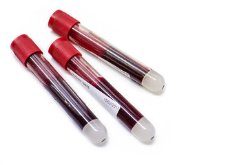Provetta medica con sangue all' interno su fondo bianco