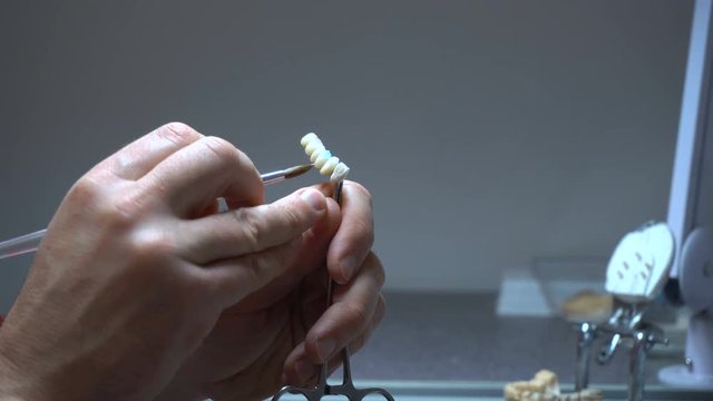 manufacture of dental crowns, close-up.