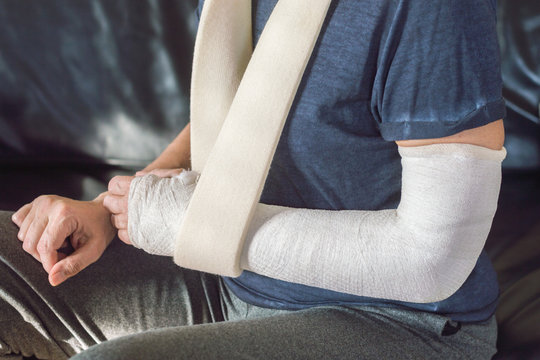 Arm in plaster - Braccio ingessato