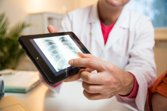 Smiling male doctor holding digital tablet, showing test results to patient in hospital. X-ray images on screen. Sick senior woman having a doctor appointment. Medical consultation.
