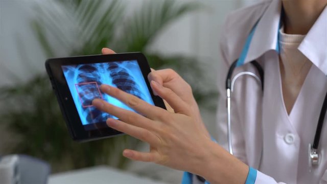 Attractive medical doctor is talking to female patient and showing her a X-ray picture on tablet while working in his office