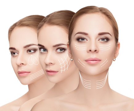  woman faces with arrows over white background. Face lifting con