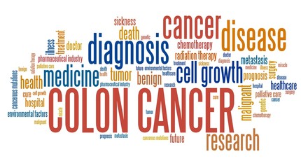Colon cancer