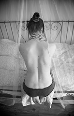 Espalda de una chica con escoliosis leve